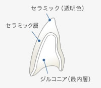 ジルコニア